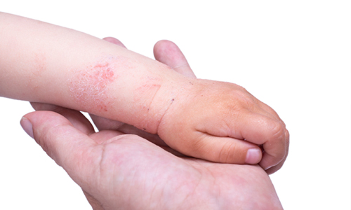 画像の説明 画像の説明