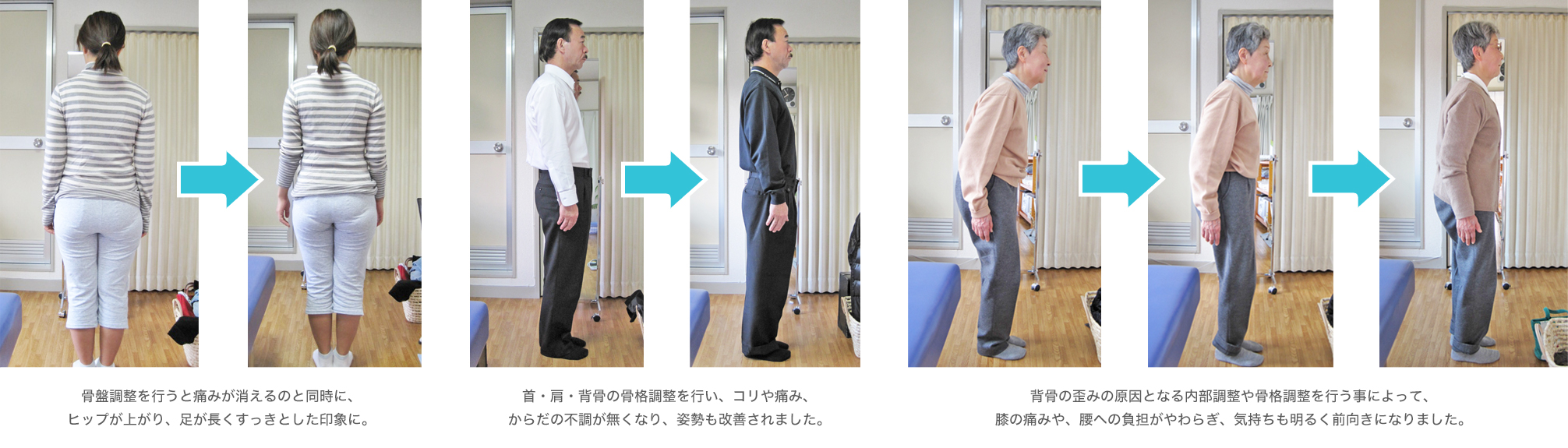 ビフォー・アフター ビフォー・アフター