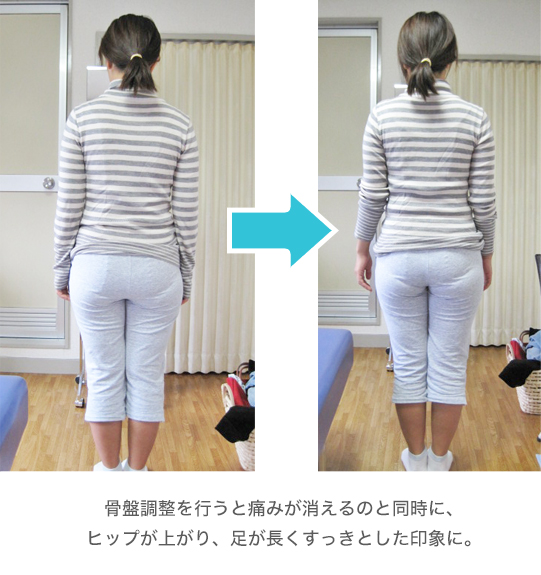 ビフォー・アフター1 ビフォー・アフター1