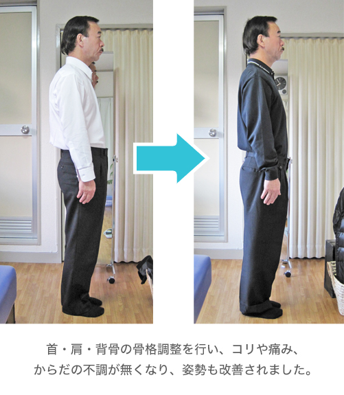 ビフォー・アフター2 ビフォー・アフター2