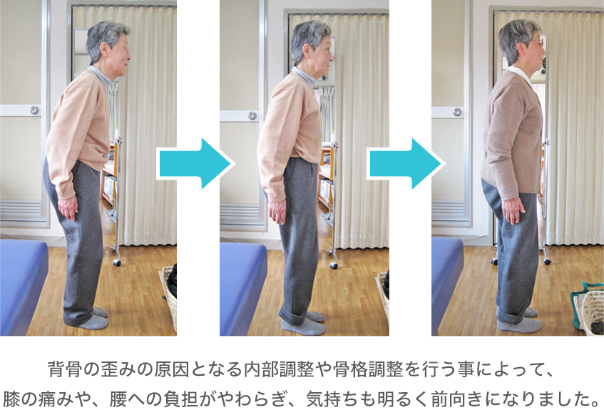 ビフォー・アフター3 ビフォー・アフター3